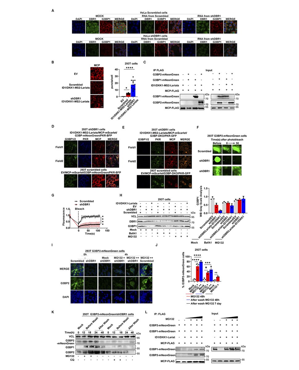 Journal of Experimental Medicine (@jexpmed) on Twitter photo Human DBR1 deficiency impairs #StressGranule–dependent PKR antiviral immunity, say Shuo Ru, Daxing Gao and colleagues (University of Science and Technology of China): hubs.la/Q02-yPYS0
<a href="/casanova_lab/">Casanova Lab</a> <a href="/ShenYingZhang1/">Shen-Ying Zhang</a>
#Immunodeficiency #InnateImmunity #InfectiousDisease Human DBR1 deficiency impairs #StressGranule–dependent PKR antiviral immunity, say Shuo Ru, Daxing Gao and colleagues (University of Science and Technology of China): hubs.la/Q02-yPYS0
<a href="/casanova_lab/">Casanova Lab</a> <a href="/ShenYingZhang1/">Shen-Ying Zhang</a>
#Immunodeficiency #InnateImmunity #InfectiousDisease