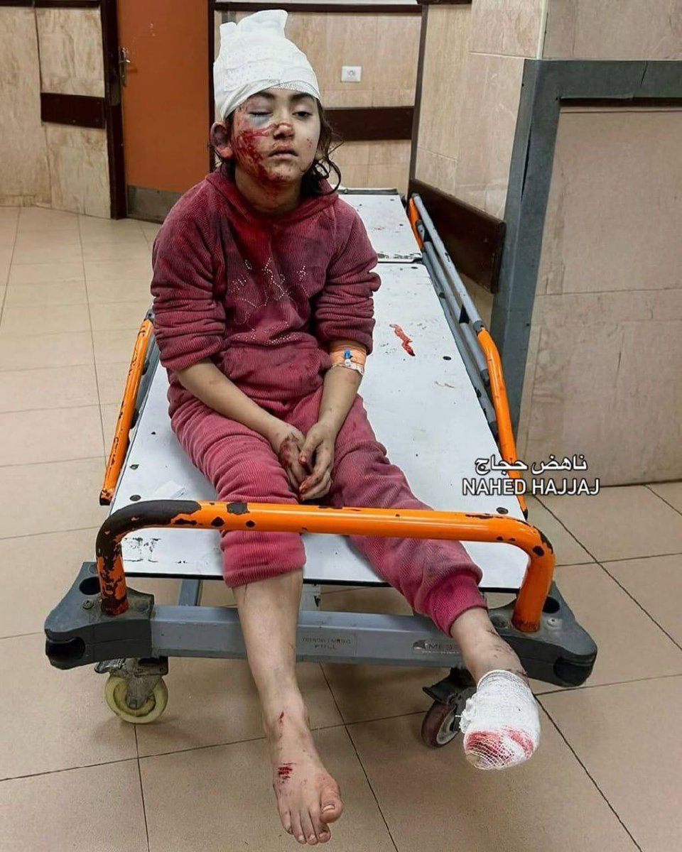 7MohammedKhaled's tweet photo. A child was injured as a result of the occupation's shelling of a number of houses in the Nuseirat camp in the central Gaza Strip. https://t.co/XXIaMG3ewd