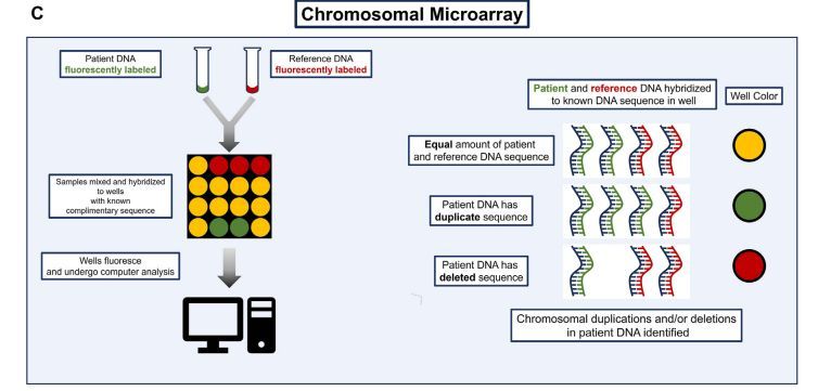 AJKD (@ajkdonline) on Twitter photo Core Curriculum by <a href="/AW_Aron88/">Abe Aron</a> and <a href="/ndahl48/">Neera Dahl</a>
Clinical Genetic Testing in Nephrology: Core Curriculum 2024
bit.ly/4eZeSrS (FREE)
<a href="/MedStarGUHNeph/">Georgetown Nephrology</a> <a href="/MayoClinicNeph/">Mayo Clinic Nephrology</a> Core Curriculum by <a href="/AW_Aron88/">Abe Aron</a> and <a href="/ndahl48/">Neera Dahl</a>
Clinical Genetic Testing in Nephrology: Core Curriculum 2024
bit.ly/4eZeSrS (FREE)
<a href="/MedStarGUHNeph/">Georgetown Nephrology</a> <a href="/MayoClinicNeph/">Mayo Clinic Nephrology</a>