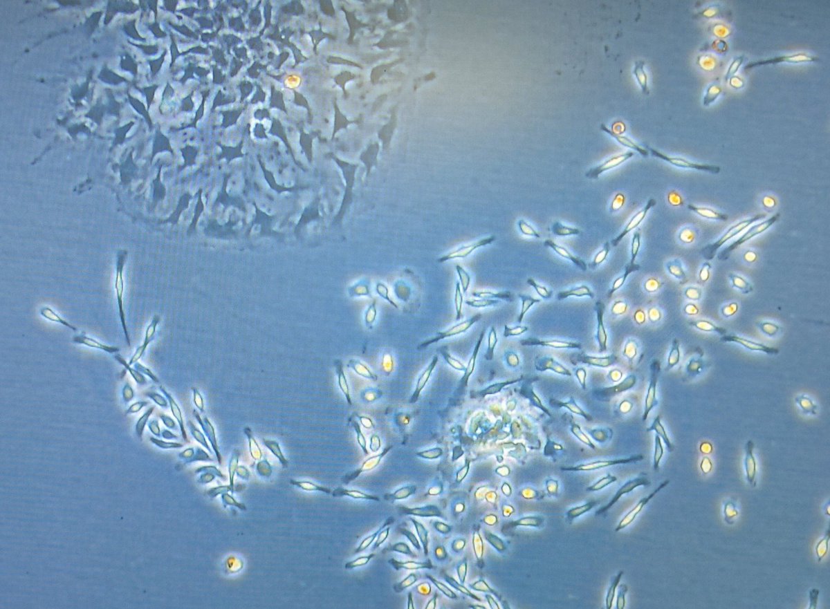 Bio_Lidia's tweet photo. Día 12 del #LabVentCalendar
🟣 Línea celular inmortalizada
Modelos por excelencia en biología celular. Son células derivadas de un organismo que, en condiciones normales, no podrían proliferar indefinidamente; pero, al haber adquirido ciertas mutaciones, evitan su senescencia. https://t.co/FOBz1Dn1GT