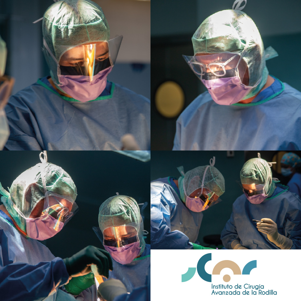 En ICAR realizamos cirugía personalizada y a medida restaurando la anatomía de la rodilla. 
✍🏼SIN LISTAS DE ESPERA, ATENCIÓN PERSONALIZADA.
.
🇪🇸+34699521642
🇬🇧 +34697411817