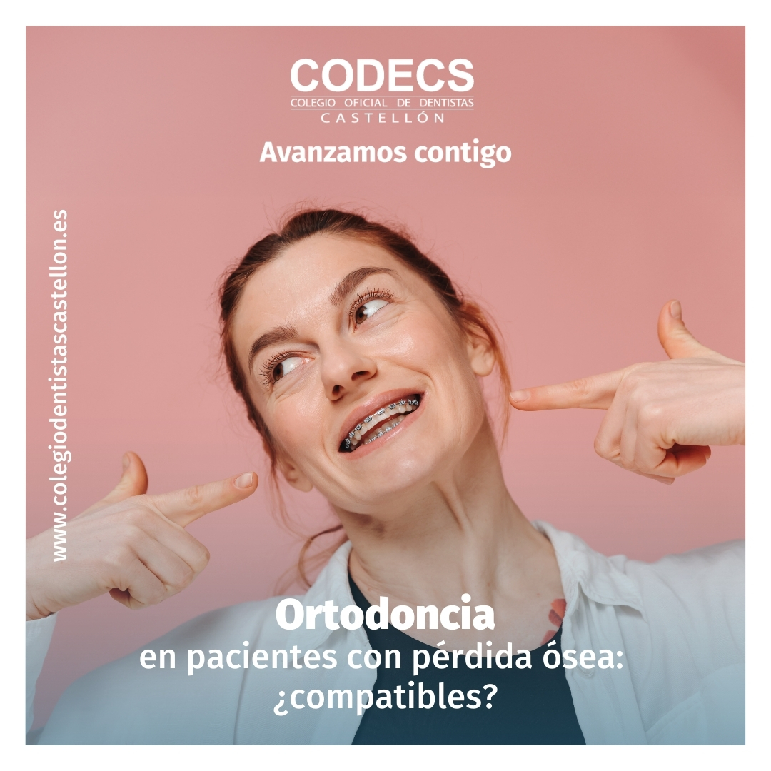 codecs_'s tweet image. Ortodoncia en pacientes con pérdida ósea: ¿compatibles?

Actualmente, es muy frecuente que pacientes periodontales adultos con pérdida ósea avanzada alrededor de sus dientes quieran realizarse ortodoncia.
👉🏻cutt.ly/LeVO6Szh