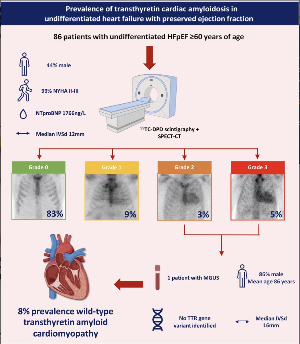 European Society of Cardiology Journals (@esc_journals) on Twitter photo Prevalence of transthyretin cardiac amyloidosis in undifferentiated heart failure with preserved ejection fraction 👉 bit.ly/3Zi34wg
<a href="/EJHFEiC/">EJHF Editor-in-Chief</a> <a href="/JanBiegus/">Jan Biegus</a> @Ppponikowski #HFA_ESC <a href="/hvanspall/">Harriette Van Spall, MD MPH 🇨🇦</a> <a href="/ShelleyZieroth/">Shelley Zieroth</a> <a href="/FudimMarat/">Marat Fudim, MD MHS</a> <a href="/gcfmd/">Gregg Fonarow MD</a> <a href="/AlexMebazaa/">Alexandre Mebazaa</a> <a href="/MarcoMetra/">Marco Metra</a> <a href="/GianluSava/">Gianluigi Savarese</a> Prevalence of transthyretin cardiac amyloidosis in undifferentiated heart failure with preserved ejection fraction 👉 bit.ly/3Zi34wg
<a href="/EJHFEiC/">EJHF Editor-in-Chief</a> <a href="/JanBiegus/">Jan Biegus</a> @Ppponikowski #HFA_ESC <a href="/hvanspall/">Harriette Van Spall, MD MPH 🇨🇦</a> <a href="/ShelleyZieroth/">Shelley Zieroth</a> <a href="/FudimMarat/">Marat Fudim, MD MHS</a> <a href="/gcfmd/">Gregg Fonarow MD</a> <a href="/AlexMebazaa/">Alexandre Mebazaa</a> <a href="/MarcoMetra/">Marco Metra</a> <a href="/GianluSava/">Gianluigi Savarese</a>