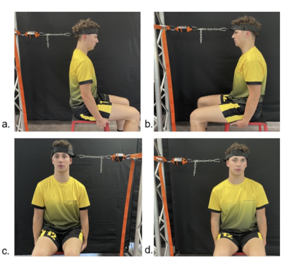 Felix Leung (@felixphysio) on Twitter photo 🚨New Publication 🚨
Decreased neck strength is a risk factor for concussion 🤕 in high school rugby union and league players 🏉 <a href="/_JSAMS/">JSAMS</a> <a href="/danbrownphysio/">Daniel Brown</a> <a href="/julie_hides/">Julie Hides</a>
jsams.org/article/S1440-… 🚨New Publication 🚨
Decreased neck strength is a risk factor for concussion 🤕 in high school rugby union and league players 🏉 <a href="/_JSAMS/">JSAMS</a> <a href="/danbrownphysio/">Daniel Brown</a> <a href="/julie_hides/">Julie Hides</a>
jsams.org/article/S1440-…