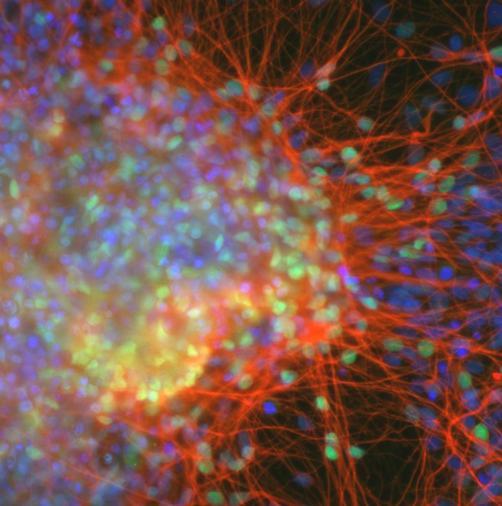 ESC & iPSC News (@esc_ipsc_news) on Twitter photo Researchers from <a href="/NTUsg/">NTU Singapore</a> discuss the practical approaches and potential applications of #iPSC techniques for generating and differentiating dopaminergic #neurons from iPSCs. 🧠
Check out their review: bit.ly/4gaW9ej Researchers from <a href="/NTUsg/">NTU Singapore</a> discuss the practical approaches and potential applications of #iPSC techniques for generating and differentiating dopaminergic #neurons from iPSCs. 🧠
Check out their review: bit.ly/4gaW9ej