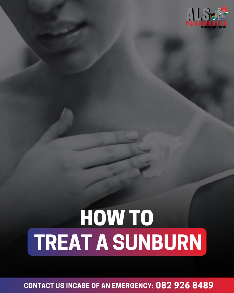 _ArriveAlive's tweet photo. Sunburn Tips for Summer Fun https://t.co/IFYyQiRmxB
#ArriveAlive #SunburnTips #SummerFun @AlsParamedics https://t.co/lXIS7qZXZt