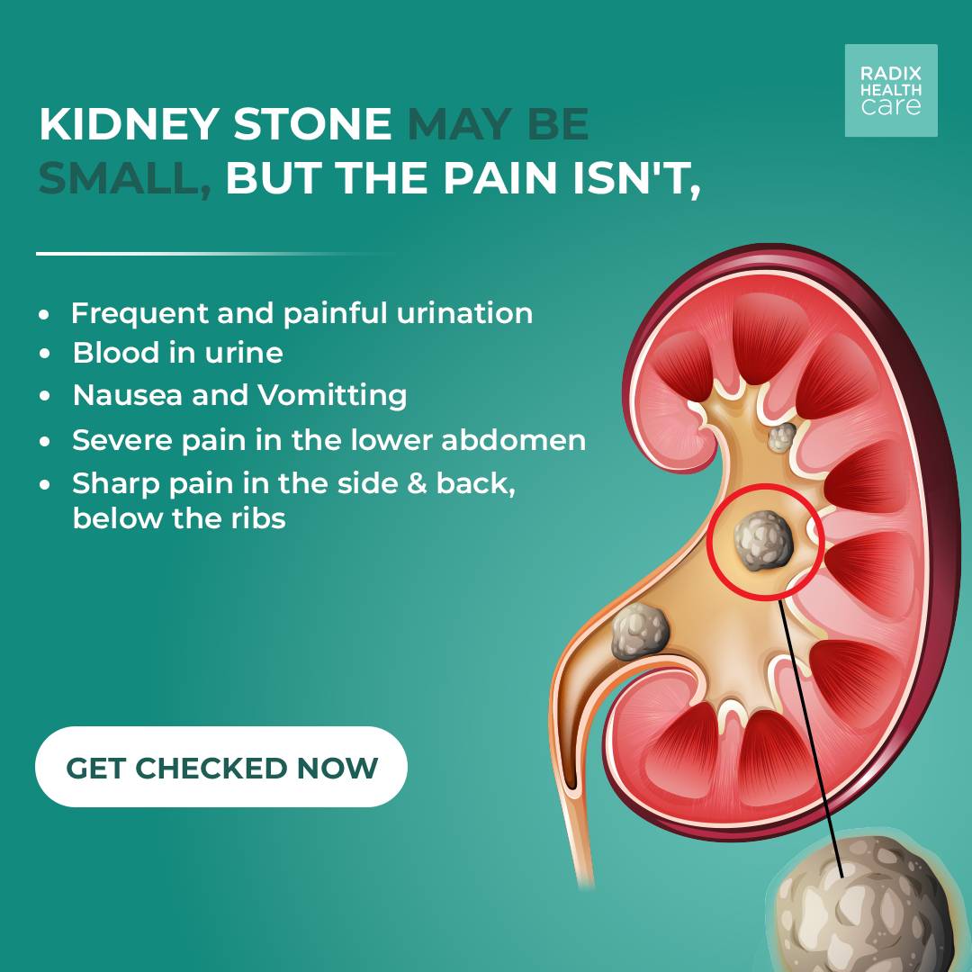 radixhealthcare's tweet photo. Kidney stone may be small, but the pain isn't.

For more details call 1800-120-5457 or visit https://t.co/O2Uydk2B18 

#radixhealthcare #stone #kidneys #kidneydisease #kidneystones #kidneyhealth #pain #health #fitness #treatment #viral #hospital #india #delhi https://t.co/uCJ7KGikeT