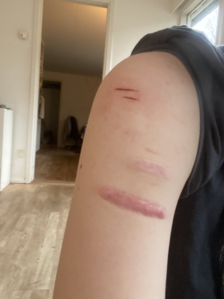 ionczts's tweet photo. Tiny cuts before school https://t.co/m0fDRMZlw7