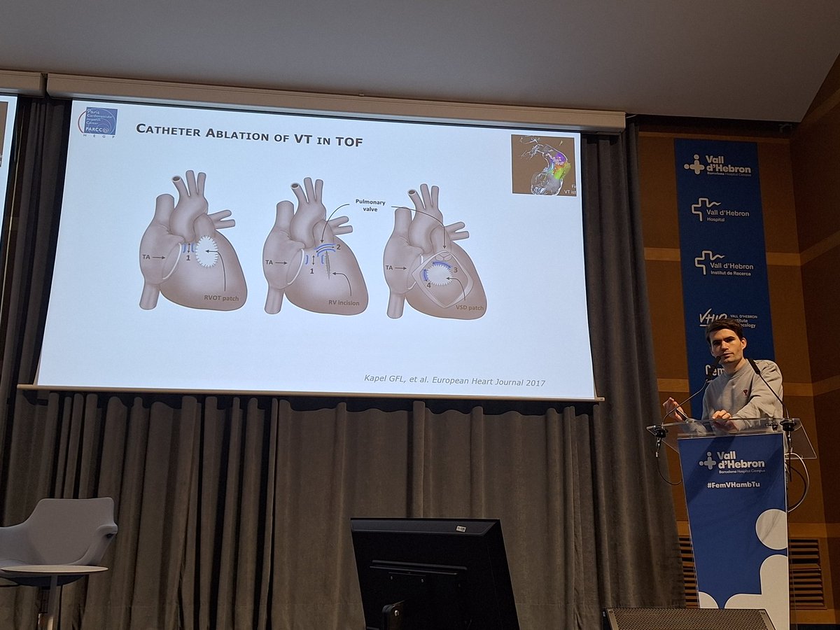 Raquel Adeliño (@raquel_adelino) on Twitter photo It's been an great honor to host <a href="/victor_waldmann/">Victor Waldmann</a> at Vall d'Hebron today, sharing his expertise on sudden death risk stratification in Tetralogy of Fallot. Huge thanks for this fantastic presentation!
<a href="/vallhebron/">Vall d'Hebron</a>
<a href="/congenites/">Cardiopaties Congènites Adult Vall d'Hebron-St Pau</a>
<a href="/J_Francisco_EP/">J.Francisco-Pascual</a>
<a href="/NRivasGandara/">Nuria</a>
<a href="/tonyapijuan/">antonia pijuan</a> It's been an great honor to host <a href="/victor_waldmann/">Victor Waldmann</a> at Vall d'Hebron today, sharing his expertise on sudden death risk stratification in Tetralogy of Fallot. Huge thanks for this fantastic presentation!
<a href="/vallhebron/">Vall d'Hebron</a>
<a href="/congenites/">Cardiopaties Congènites Adult Vall d'Hebron-St Pau</a>
<a href="/J_Francisco_EP/">J.Francisco-Pascual</a>
<a href="/NRivasGandara/">Nuria</a>
<a href="/tonyapijuan/">antonia pijuan</a>