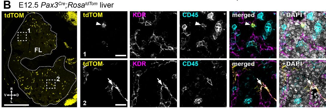Development (@dev_journal) on Twitter photo A Pax3 lineage gives rise to transient haematopoietic progenitors
Read this #OpenAccess Research Report by Giovanni Canu <a href="/Gio_Canu/">Giovanni Canu</a>, Christiana Ruhrberg @ruhrberglab <a href="/UCLeye/">UCL Institute of Ophthalmology</a> and colleagues:
doi.org/10.1242/dev.20… A Pax3 lineage gives rise to transient haematopoietic progenitors
Read this #OpenAccess Research Report by Giovanni Canu <a href="/Gio_Canu/">Giovanni Canu</a>, Christiana Ruhrberg @ruhrberglab <a href="/UCLeye/">UCL Institute of Ophthalmology</a> and colleagues:
doi.org/10.1242/dev.20…