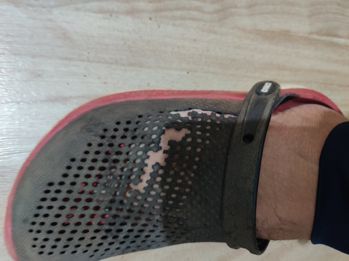 aslahkhan's tweet image. Extremely frustrated with @CrocsIndia.

Bought premium Crocs for ₹6999, and they’re already damaged after just 7 months of occasional use!
As a loyal customer for over 10 years, I demand a refund or replacement immediately!
#QualityIssue #customerservice @CrocsSupport