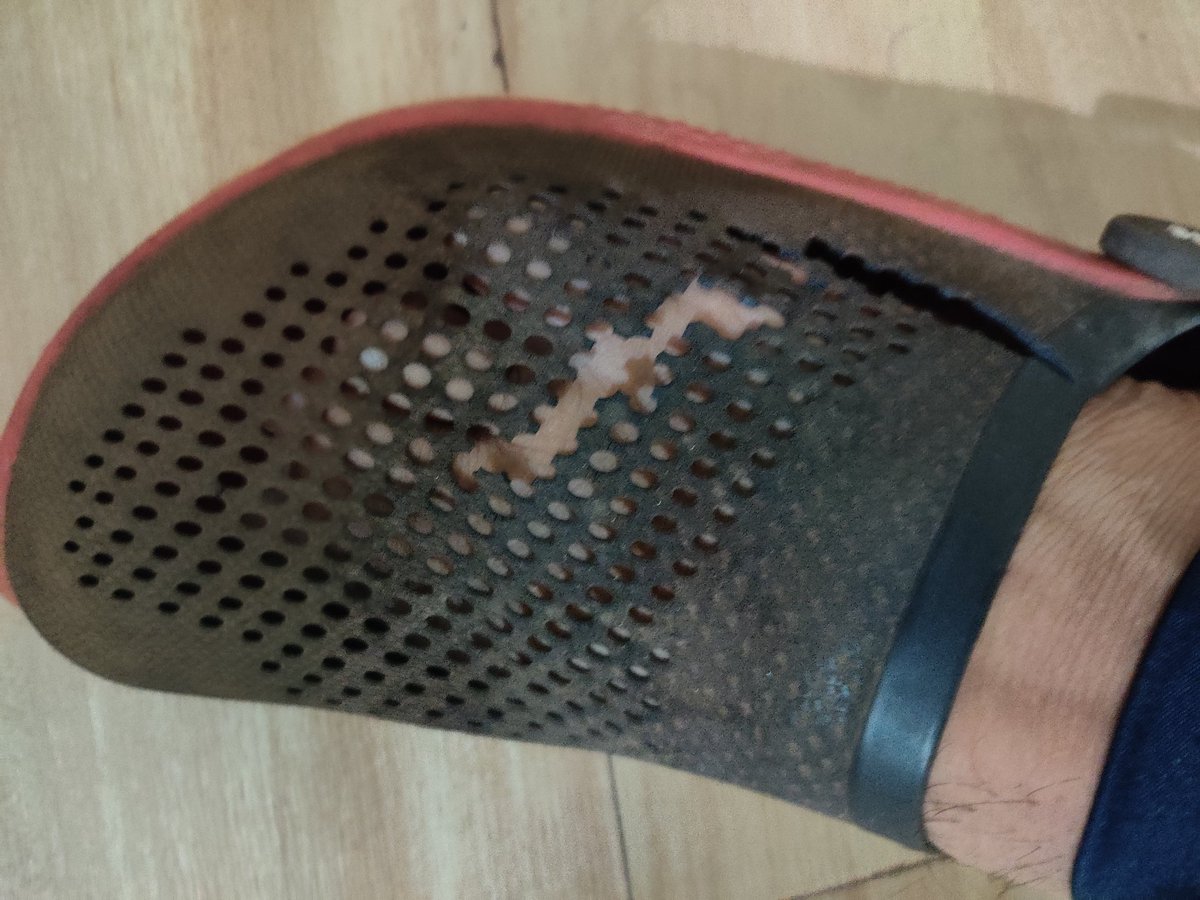 aslahkhan's tweet image. Extremely frustrated with @CrocsIndia.

Bought premium Crocs for ₹6999, and they’re already damaged after just 7 months of occasional use!
As a loyal customer for over 10 years, I demand a refund or replacement immediately!
#QualityIssue #customerservice @CrocsSupport