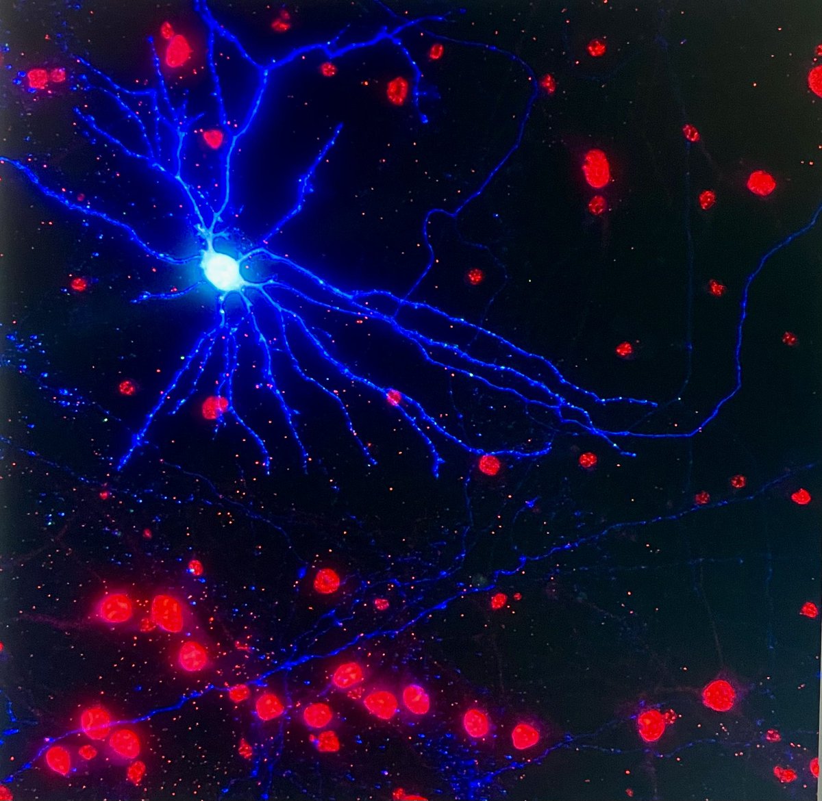 Shorton_Neuro's tweet image. Having a bit of fun before Christmas and enjoying postdoc life🎄Happy #FluorescentFriday ✨