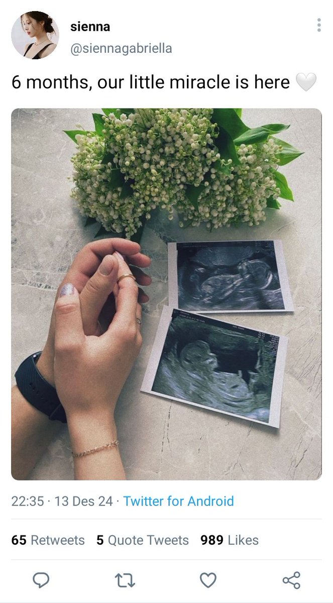 fleurrascent's tweet photo. 326. 'our' little miracle https://t.co/2ufX3Lq8mf