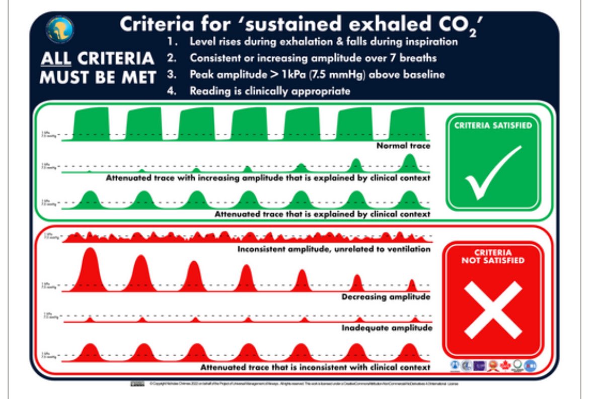 Tim Cook (@doctimcook) on Twitter photo <a href="/SafeAirway/">Safe Airway Society</a> <a href="/NicholasChrimes/">Nicholas Chrimes</a> <a href="/AndyHiggsGAA/">Andy HIGGS</a> <a href="/Anaes_Reports/">ππ―π’π¦π΄π΅π©π¦π΄πͺπ’ ππ¦π±π°π³π΅π΄</a> Absolutely!!
The correct phrase is
Sustained exhaled carbon dioxide
Criteria and examples in the infographic <a href="/SafeAirway/">Safe Airway Society</a> <a href="/NicholasChrimes/">Nicholas Chrimes</a> <a href="/AndyHiggsGAA/">Andy HIGGS</a> <a href="/Anaes_Reports/">ππ―π’π¦π΄π΅π©π¦π΄πͺπ’ ππ¦π±π°π³π΅π΄</a> Absolutely!!
The correct phrase is
Sustained exhaled carbon dioxide
Criteria and examples in the infographic