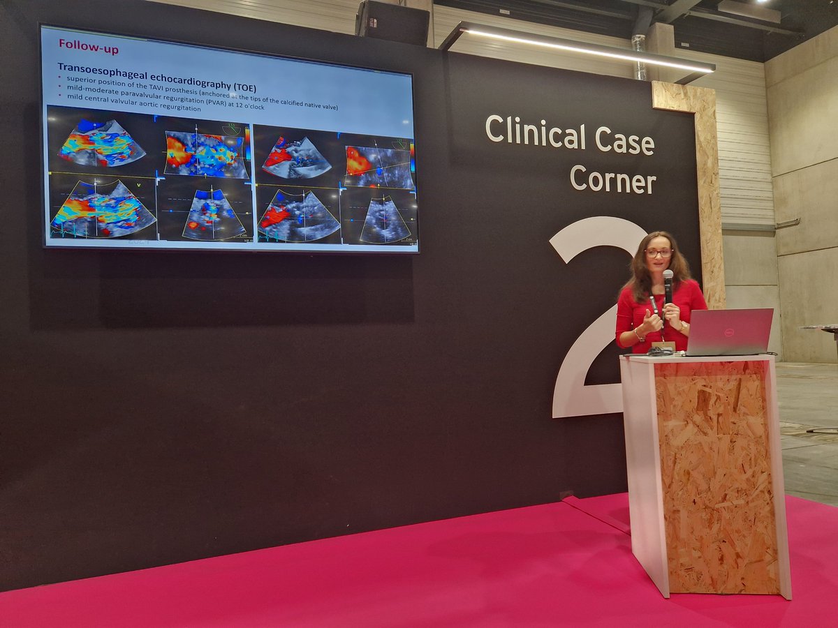 Tomaz Podlesnikar (@tomazp3) on Twitter photo It was supernice to see a strong 🇸🇮delegation at #EuroEcho2024! Huge 👏to <a href="/CvijicMarta/">Marta Cvijic</a> <a href="/suzidanojevic/">SuzyD</a> <a href="/gloriakotnik8/">Gloria Kotnik</a> and others who presented their research and clinical cases and put Slovenian imaging community on the #EACVI map🙏🚀 <a href="/EACVIPresident/">EACVI President</a> <a href="/VDelgadoGarcia/">Victoria Delgado</a> <a href="/denisamuraru/">Denisa Muraru</a> It was supernice to see a strong 🇸🇮delegation at #EuroEcho2024! Huge 👏to <a href="/CvijicMarta/">Marta Cvijic</a> <a href="/suzidanojevic/">SuzyD</a> <a href="/gloriakotnik8/">Gloria Kotnik</a> and others who presented their research and clinical cases and put Slovenian imaging community on the #EACVI map🙏🚀 <a href="/EACVIPresident/">EACVI President</a> <a href="/VDelgadoGarcia/">Victoria Delgado</a> <a href="/denisamuraru/">Denisa Muraru</a>