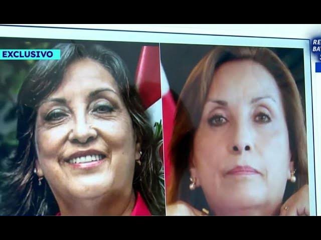 ElianaCarlin's tweet image. “Tuve una intervención quirúrgica que no fue estética, fue necesaria, imprescindible para mi salud”. 

😏 👇🏾