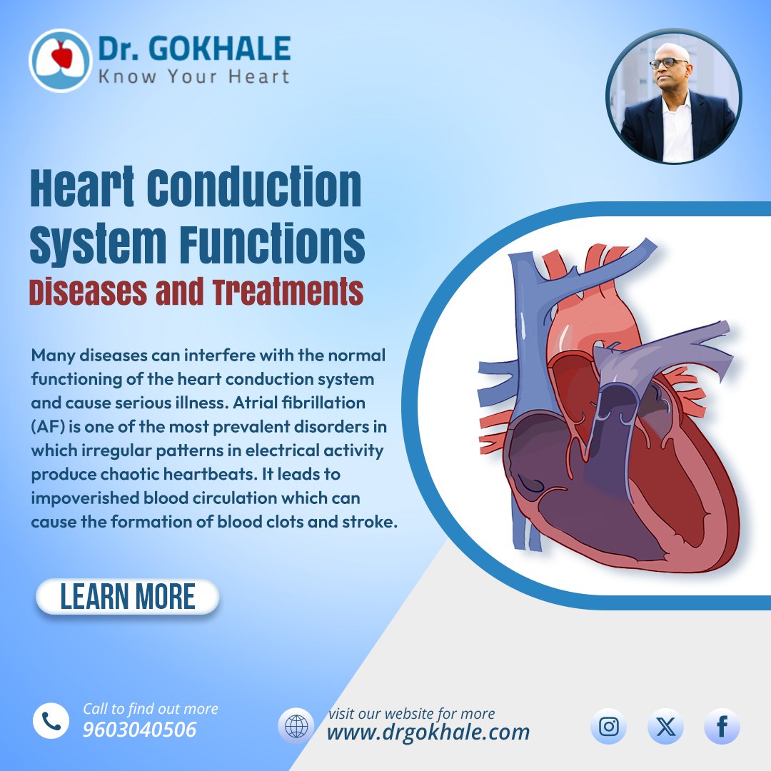 DrGokhaleAGK's tweet image. #HeartConductionSystem Functions Diseases and Treatments.

drgokhale.com/blog/heart-con…
Contact:
Dr. Alla Gopala Krishna Gokhale
MS, MCh,DNB,SMP(IIM-C)
Director, Heart &amp;amp; Lung Transplantation
Sr. Consultant Cardiothoracic Surgeon
Apollo Hospitals, Jubilee Hills, Hyderabad
9603040506.