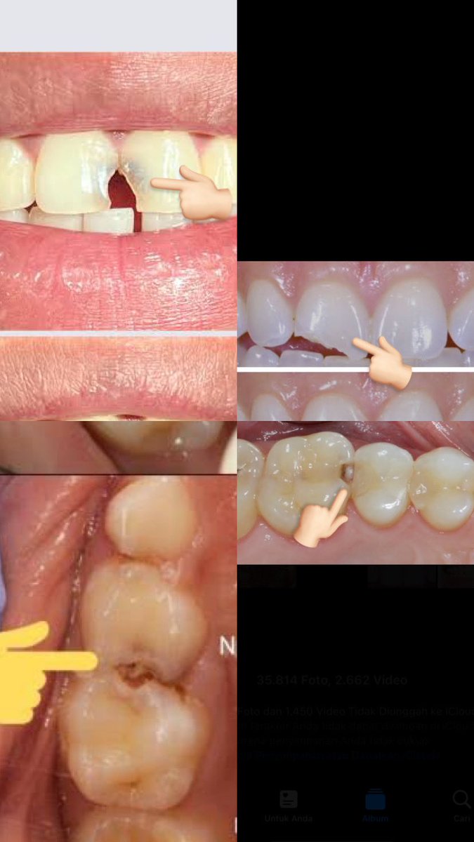 Koas Gigi Jogja tweet media