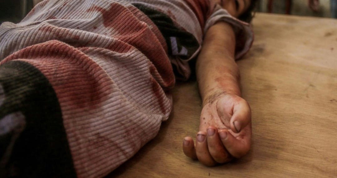alswolf's tweet photo. "Solo 4 anni. Un unico colpo. Dove appoggerei il fonendoscopio per sentire il suo cuore. Non è un errore, non è un caso"

Federica Iezzi @federicaiezzi, chirurga pediatrica di MSF, dalla Striscia di #Gaza. https://t.co/KH27jbRa2E