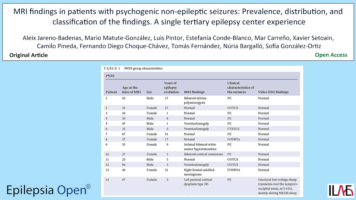 Epilepsia Open (@epilepsiaopen) on Twitter photo Key point: MRI anomalies in patients with PNES are common, including lesions typically linked to epilepsy.
doi.org/10.1002/epi4.1…
#epilepsy #ILAE #dissociation #MRI #neuroimaging #PNES <a href="/IlaeWeb/">International League Against Epilepsy</a> <a href="/WileyNeuro/">Wiley Neuro</a> @Epilepsiaopen Key point: MRI anomalies in patients with PNES are common, including lesions typically linked to epilepsy.
doi.org/10.1002/epi4.1…
#epilepsy #ILAE #dissociation #MRI #neuroimaging #PNES <a href="/IlaeWeb/">International League Against Epilepsy</a> <a href="/WileyNeuro/">Wiley Neuro</a> @Epilepsiaopen