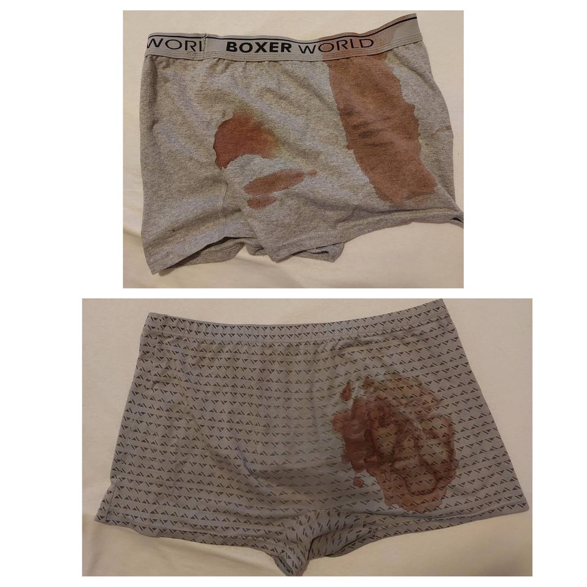 Veritas_kz's tweet photo. 8/15
After the trial in August 2023, I was specially sent to the colony in #Atbasar, #Akmola region, where they began to torture me. The colony employees tortured me until I lost consciousness, brought me back to consciousness and tortured me again. I underwent surgery. https://t.co/jZUy9J8ziH