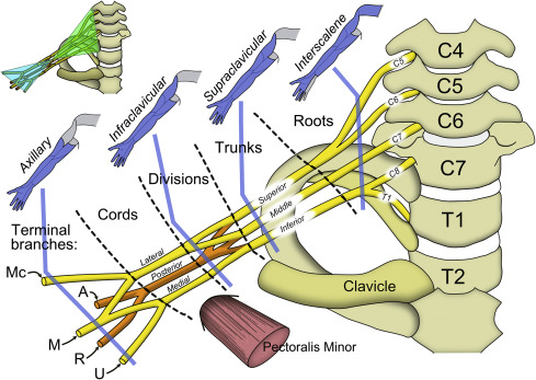 Omid_HopeUni's tweet image. Brachial plexus anatomy

A) axillary nerve
M) median nerve
Mc) musculocutaneous nerve
R) radial nerve
U) ulnar nerve

#anatomy #upperlimb #nerve

bjaed.org/article/S2058-…