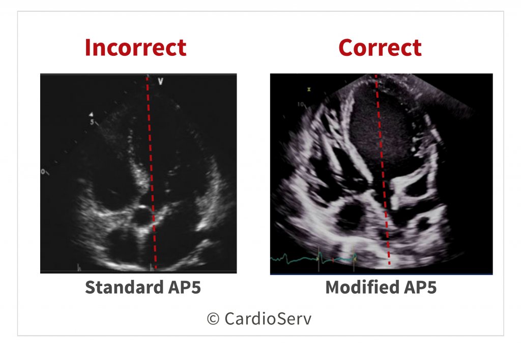 Ahmedata7777's tweet photo. Doppler cursor should be parallel to the flow!

@CardioServ https://t.co/B8etbKEMFW