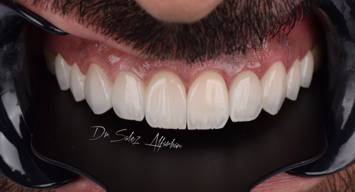 د.صالح ال فرحان tweet media