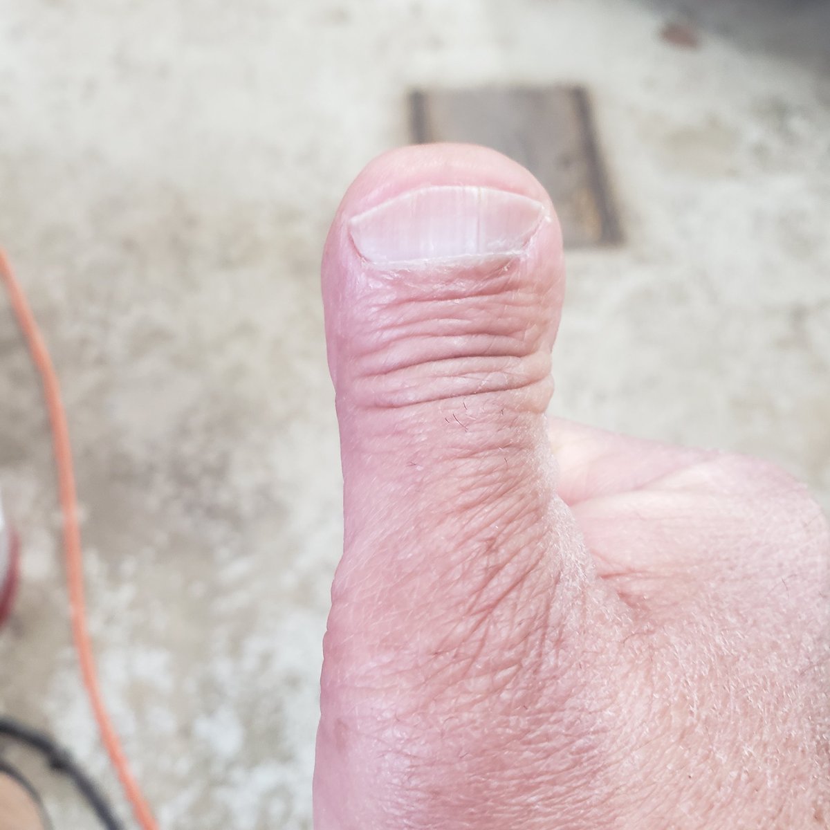 shart ⚡ in the forest ⚡Greg tweet media