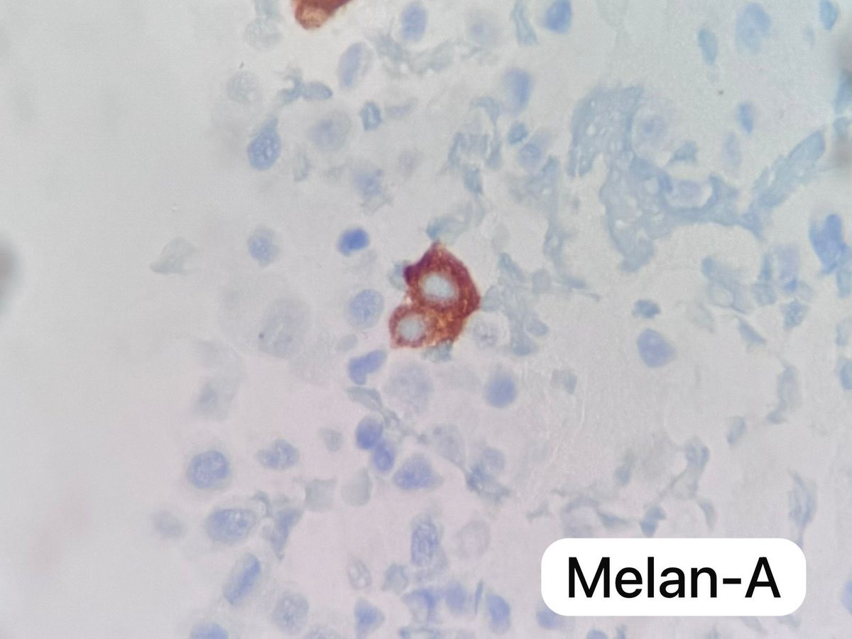 Mauro Saieg, MD, PhD, FIAC tweet media