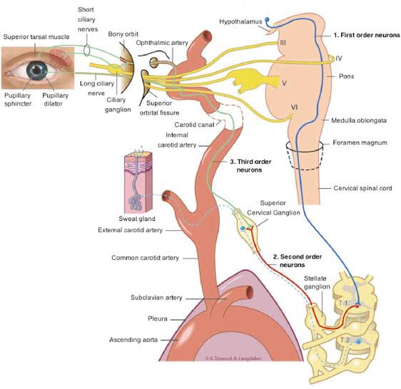 RebMedicina's tweet photo. 📌VÍA OCULOSIMPÁTICA, parte del sistema nervioso autónomo 

Sus funciones incluyen:
🔹Dilatación pupilar
🔷Inervación de la cara (endotelio y glándulas sudoríparas)

Lesiones en esta vía pueden ocasionar paresis oculosimpática conocida como Sx de Horner

#MedEd #FOAMed https://t.co/jn3kpW6Rda