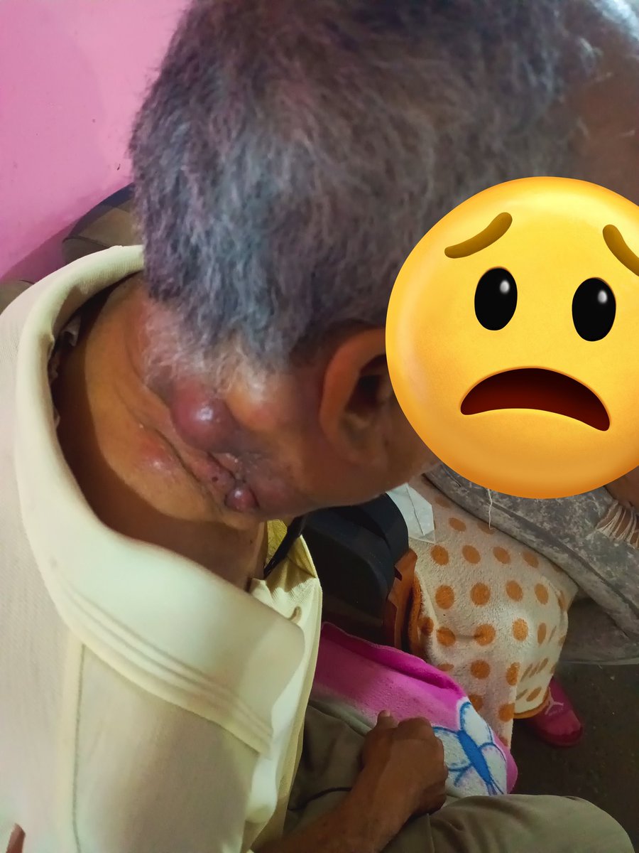 LuisReyes_30's tweet photo. #URGENTE. Hasta ahora, se han recaudado 3.182 Bs (unos 63$), en la cuenta de su sobrina . El estudio q se debe hacer, sale en 250$, por lo cuál faltan 187$.
Un ángel envío 2000 Bs, mil gracias 🫂.
Sigamos difundiendo por favor.
Con 1$ podemos apoyar.
Abajo el pago móvil.
#Ayuda https://t.co/6vw89XIKN5