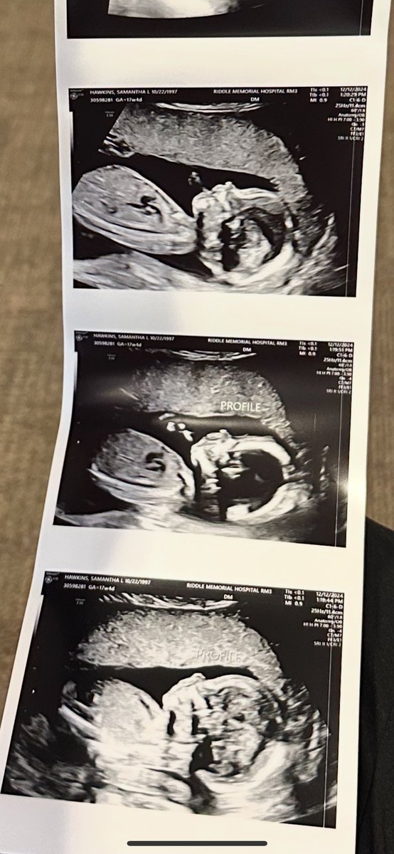 sammibabyxoxo1's tweet photo. Sharing on twitter too bc I’m just so obsessed over the fact that we’re having a babyyy💖💙👶🏼 https://t.co/IOwV3HnZJB