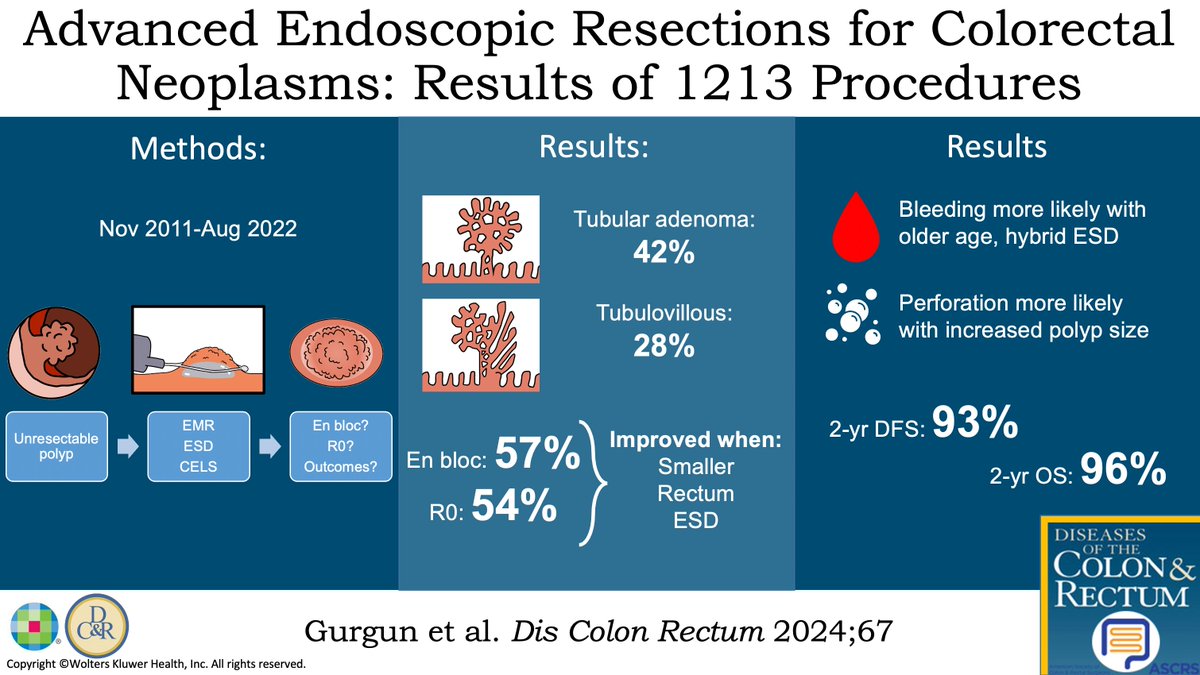 DCRjournal (@dcrjournal) on Twitter photo #DCRJournal visual abstract | Predictors of En Bloc, R0 Resection, and Postprocedural Complications After Advanced Endoscopic Resections for Colorectal Neoplasms: Results of 1213 Procedures: bit.ly/4dANRLL
<a href="/drjamestaylor/">James Taylor</a> <a href="/KarasJoshua/">Joshua R Karas MD</a> <a href="/MaloneyNell/">Nell Maloney Patel</a> <a href="/Averywalker21/">Avery Walker, MD, FACS, FASCRS</a> #DCRJournal visual abstract | Predictors of En Bloc, R0 Resection, and Postprocedural Complications After Advanced Endoscopic Resections for Colorectal Neoplasms: Results of 1213 Procedures: bit.ly/4dANRLL
<a href="/drjamestaylor/">James Taylor</a> <a href="/KarasJoshua/">Joshua R Karas MD</a> <a href="/MaloneyNell/">Nell Maloney Patel</a> <a href="/Averywalker21/">Avery Walker, MD, FACS, FASCRS</a>