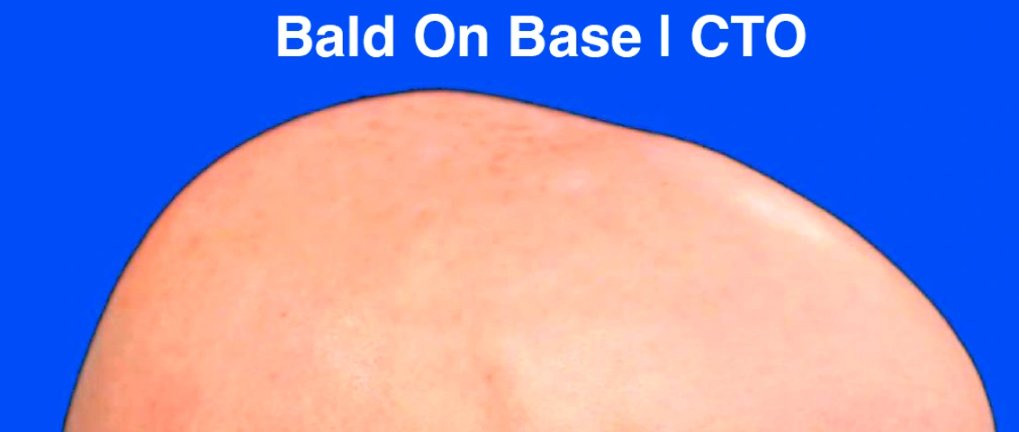 Mateuszef tweet media