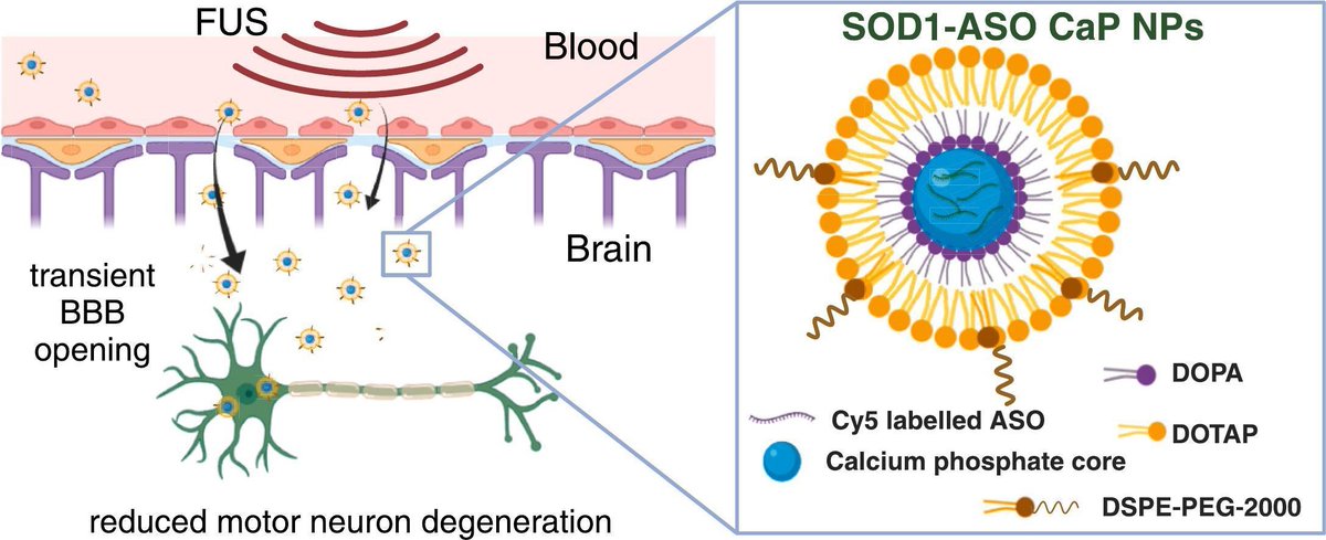 JCRnEDITORS's tweet photo. Lipid nanoparticles and transcranial focused ultrasound enhance the delivery of SOD1 antisense oligonucleotides to the murine brain for ALS therapy.
| Kara L. Vine @UOW | @AustralianCRS @DrKLVine
#BrainDelivery #olionucleotide #ultrasound 
https://t.co/CJJEKJ2eyW https://t.co/1ok6IkUIw7