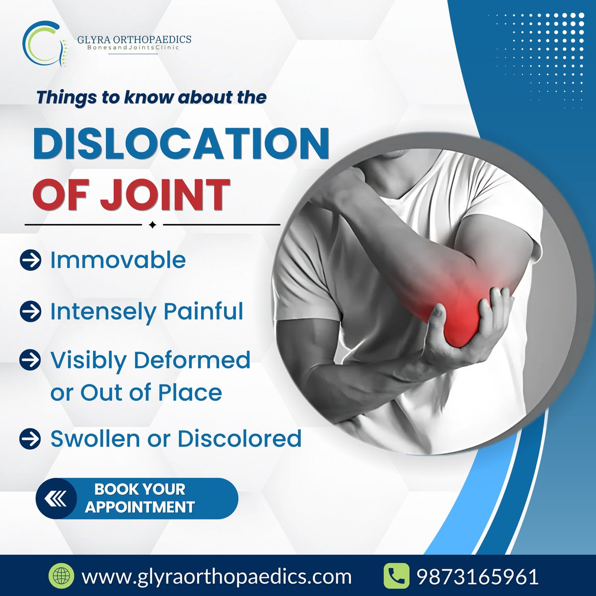 glyraortho's tweet photo. Know the Signs of Joint Dislocation! Immovable, intensely painful, visibly deformed, or swollen? Don’t delay—seek expert care.
Book your appointment with Glyra Orthopaedics
Call: 98731-65961
#GlyraOrthopaedics #JointDislocation #Orthopaedics #JointHealth #BoneCare https://t.co/29VYricAuy