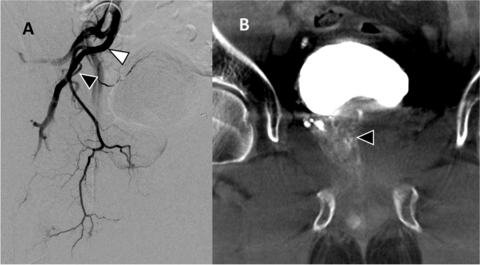 CVIR Endovascular tweet media