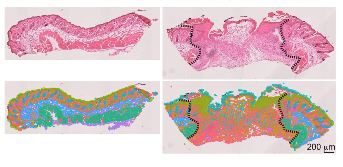 Some Senescent Cells Heal, Others Hinder

In a new study, UConn School of Medicine researchers describe how to distinguish between senescent cells that speed wound healing and those that hinder it

today.uconn.edu/2024/12/some-s… <a href="/UCToday/">UConn Today</a>