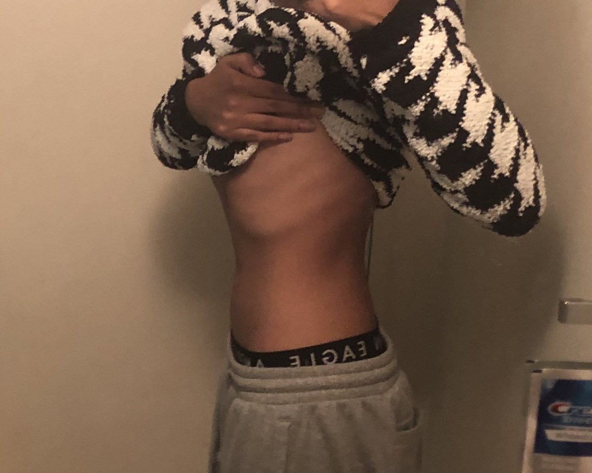 bl0od7y's tweet photo. bc except its b4  bloating n after ^__^ ! https://t.co/OLbSrl1knf