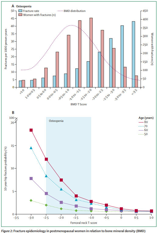 The Lancet Diabetes & Endocrinology (@thelancetendo) on Twitter photo The diagnosis of #osteopenia is not an indication for either intervention or reassurance, but #BMD is a risk factor that should be incorporated into a quantitative #fracture risk calculation thelancet.com/journals/landi…  
#osteoporosis #BoneHealth The diagnosis of #osteopenia is not an indication for either intervention or reassurance, but #BMD is a risk factor that should be incorporated into a quantitative #fracture risk calculation thelancet.com/journals/landi…  
#osteoporosis #BoneHealth