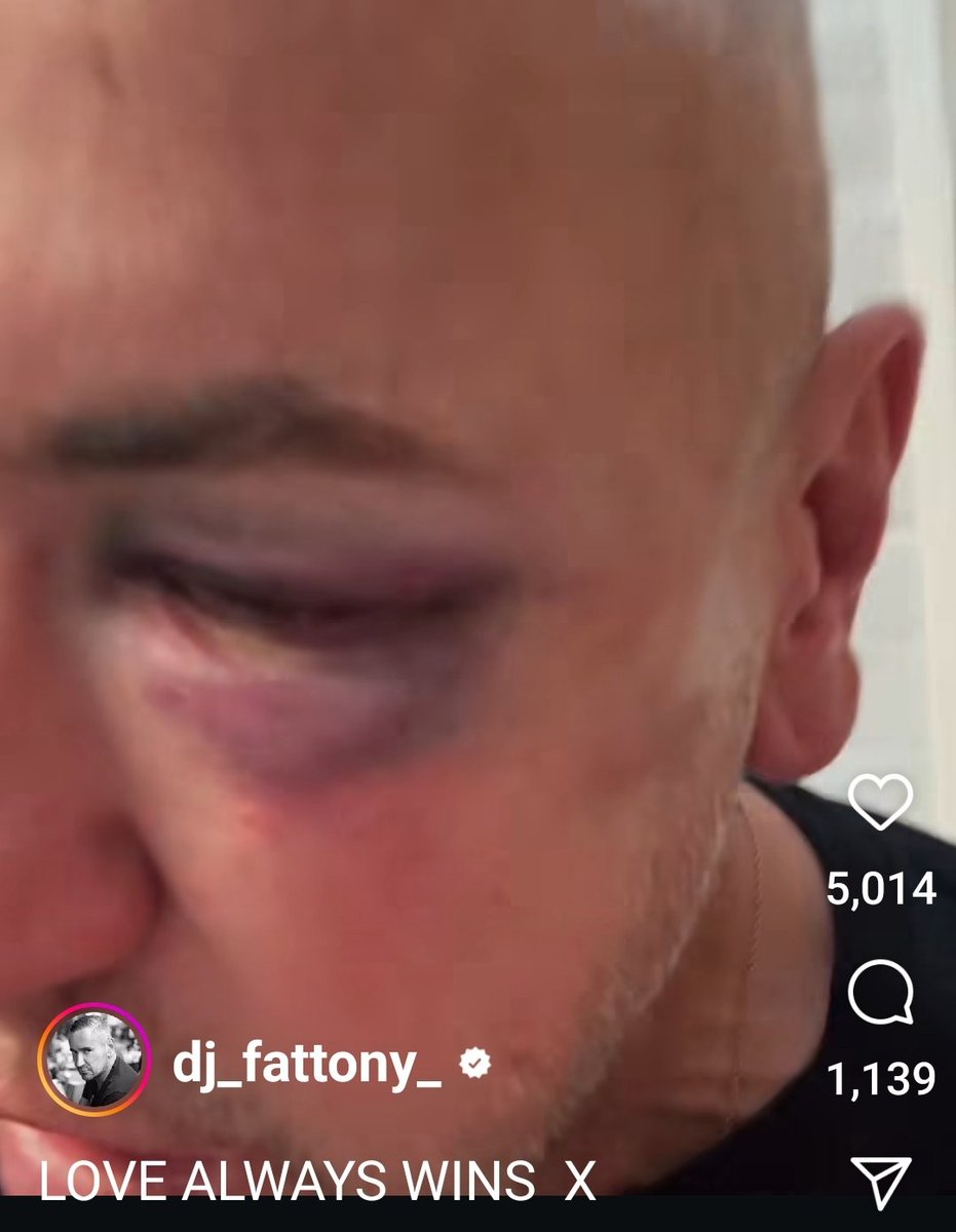 ClaireGffc's tweet photo. @thefattony absolutely appalling to hear of the assault of tony by another dj at the @margatelido last night .I hope the culprit is  prosecuted and shunned by the scene https://t.co/tboqTb8boD