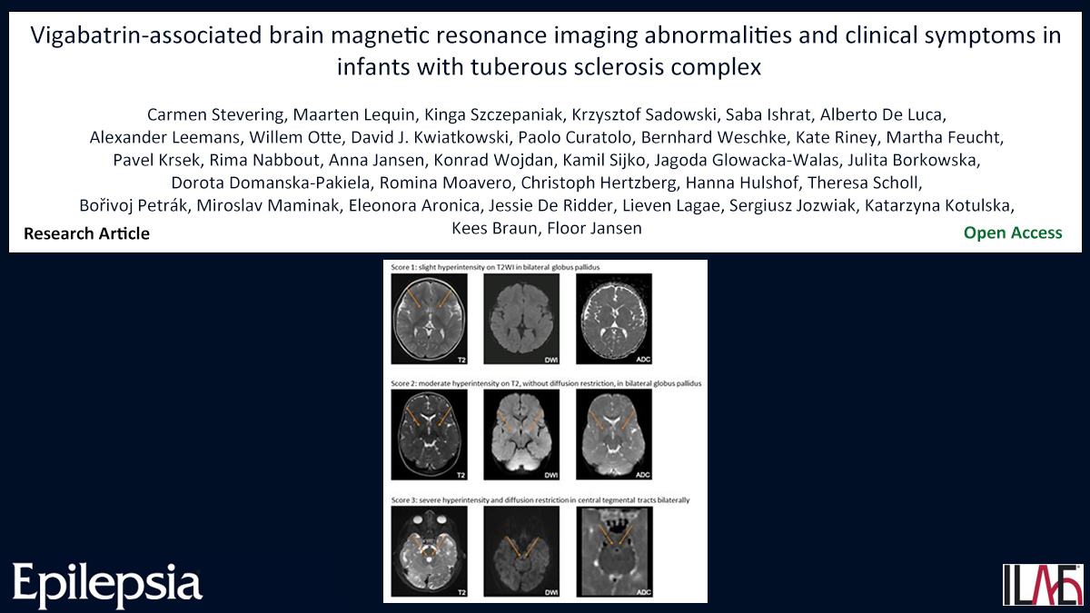 EpilepsiaJourn's tweet photo. Key point: VGB is associated with characteristic brain abnormalities on MRI in infants with TSC, but these MRI lesions disappear over time.
https://t.co/XUMPlTSuzL
#epilepsy #ILAE #brainMRI #tuberoussclerosiscomplex #vigabatrin @IlaeWeb @WileyNeuro @epilepsiajourn https://t.co/8XFekVv01X