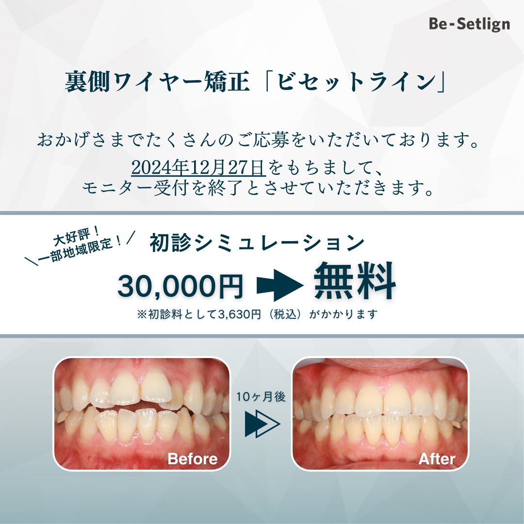 おうち矯正 U字型枕 [ラテックス] ビッグサイズ‐商品詳細ページ｜金澤屋