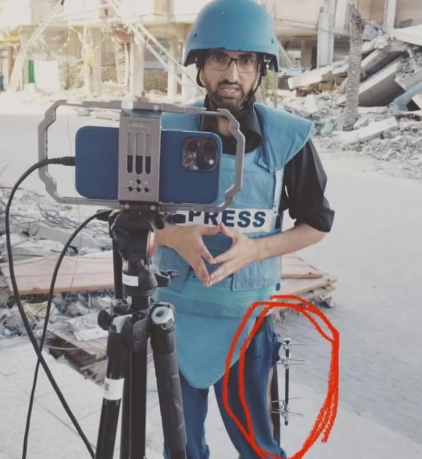 الصحفي محمد كان جريح يقف على قدم واحدة لينقل لكم الصورة 

قتلته اسرائيل اليوم، فجرت به قنبلة في صمت تام!

إلى رحمة اللّه يا بطل