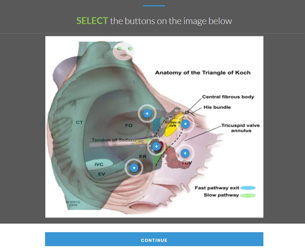 ChartAcademy's tweet photo. ๐ชStart your 2025 career learning journey on January 14th with 3D Anatomy in the EP Lab. ๐ซ
1-Read our blog!
๐ https://t.co/SVrM4dm61u
2-Join GROW
๐ฑ https://t.co/65rNCiORe4
3-Cardiac Anatomy course
๐ https://t.co/fsAoAxhGrN
#EPGoals #3DAnatomy #EPeeps #VivaEP #RCES https://t.co/O3EfVRHxEB