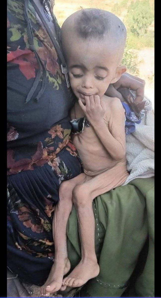 tabor97's tweet photo. 🆘 please Be a Voice for Humanitarian Aid in Amhara Region.

@AbiyAhmedAli is using starvation as punishment by blocking aid and denying life-saving food and medicine in Amhara region . https://t.co/JLIurVXve1