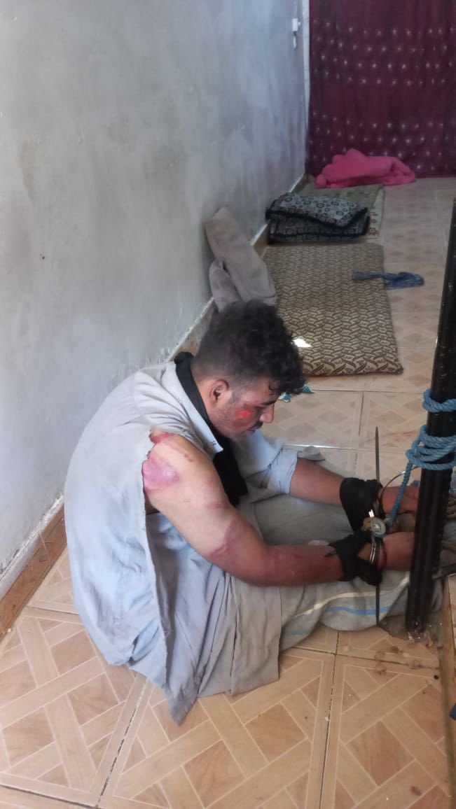 تعرض الى انواع التعذيب وفقد عقلة وانفصام بالشخصية بسبب تمزيق صورة ايراني بالعراق …

ماعرف هلبشر وين يريدون يوصلون ليش تحجون ع نظام السابق وافعالكم صارت انكس الى الله المشتكى 

#الحرية_لعبدلله_حسين
