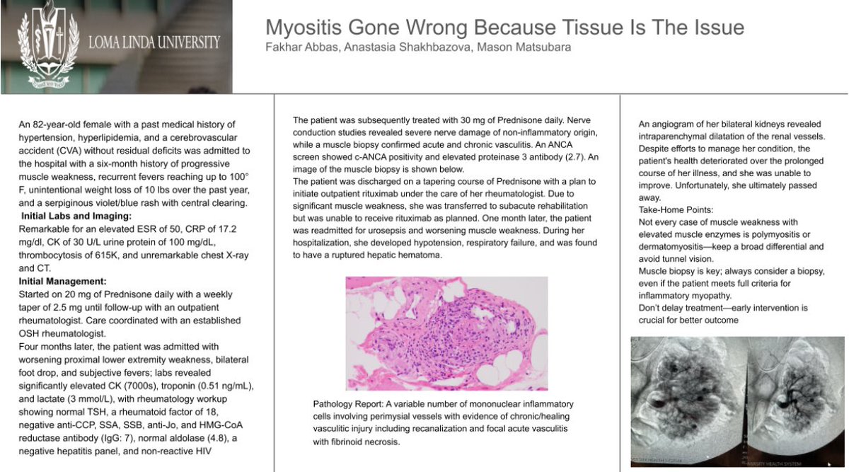 Fakhartwelver's tweet photo. It was amazing presenting 2 interesting cases from #LomaLindaUniversity #DepartmentOfRheumatology
At #SCRS #MyositisSymposium https://t.co/E09CTcOWkR